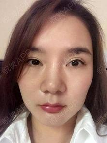 吃瓜抠鼻子教程视频大全,吃瓜抠鼻子教程视频大全汇总